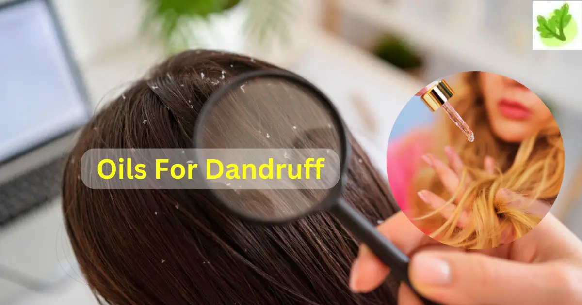 Oils For Dandruff